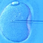 ivf